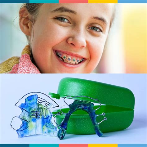 Orthodontics Australia | The Difference Between Orthodontic Teeth Plate For Kids And Braces