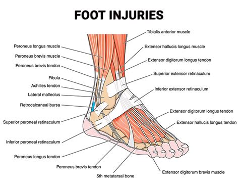 Foot Injuries (Treatment, Recovery) | Premier Podiatry