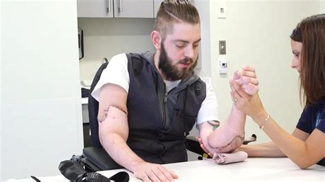 Veteran receives one of the world’s first double arm transplants