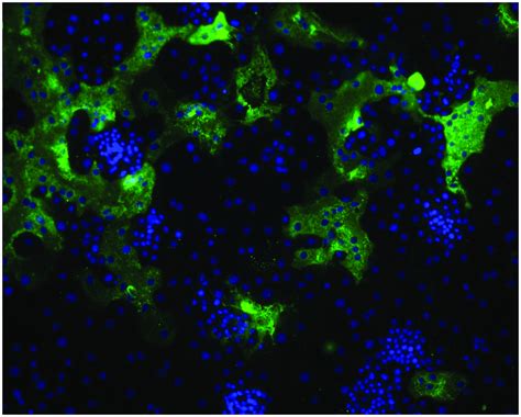 Formation of large syncytia of primary human alveolar type II cells ...