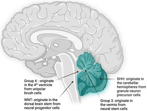 Diagnostics | Free Full-Text | Subgroup-Specific Diagnostic, Prognostic, and Predictive Markers ...