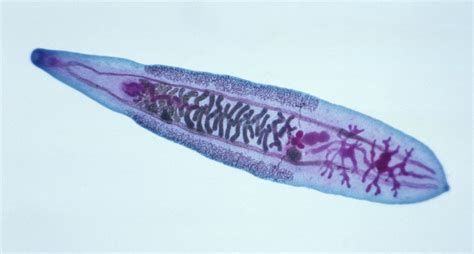 Liver Flukes: Types, Complications, Prognosis