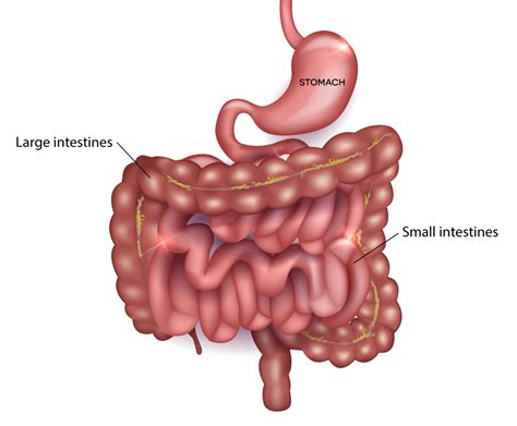 Dysmotility: Causes, Types, and Treatments | Colon & Rectal Surgical ...