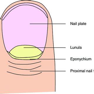 Subungual hyperkeratosis. | Download Scientific Diagram