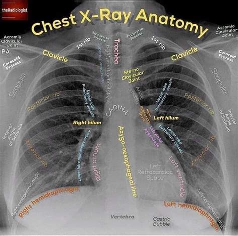 Pin by Donna Baker on ANATOMY | Radiology, Medical anatomy, Anatomy