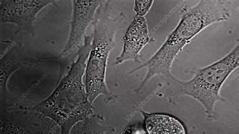 HeLa cells in culture, light microscopy - Stock Video Clip - K005/6160 - Science Photo Library