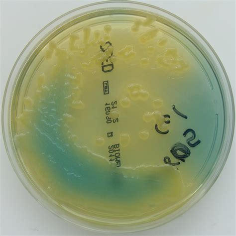 Klebsiella pneumoniae on C.L.E.D. Agar | Klebsiella pneumoni… | Flickr