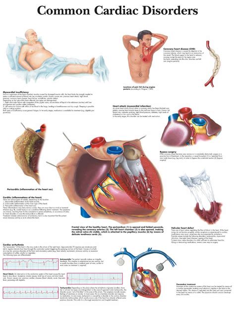 Diseases That Affect The Cardiovascular System