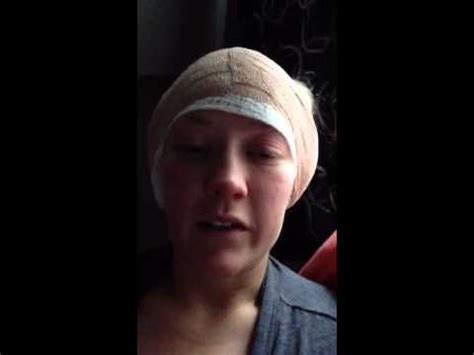 Otoplasty Recovery Day 1 - YouTube