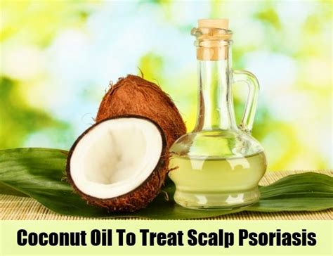 TOP 5 TREATMENTS FOR SCALP PSORIASIS ~ Mzizi Mkavu