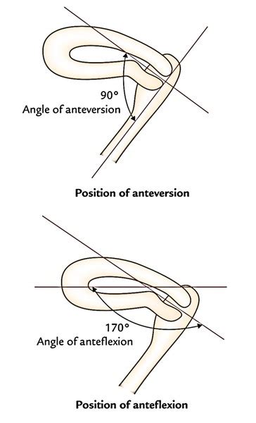 Easy Notes On 【Uterus】Learn in Just 4 ... | Uterus, Arteries, Medical ultrasound