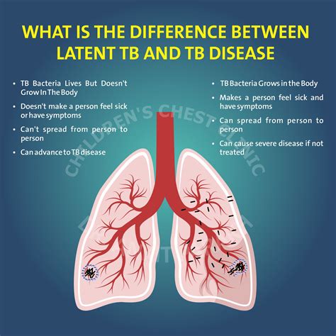 Latent Tuberculosis or Tuberculosis disease: What is the difference ...