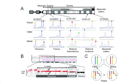 | Molecular findings of our case. (A) Microsatellite analysis revealed... | Download Scientific ...