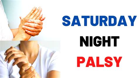 Saturday Night Palsy (Wrist Drop) Causes, Symptoms, Treatment of Radial Nerve Palsy - YouTube