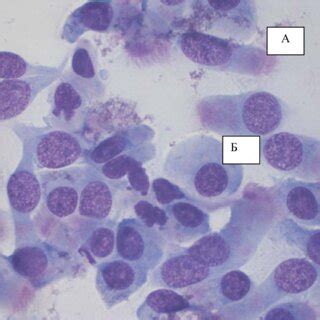 Brush microbiopsy of the nasal mucosa. Normal manifestations of ...