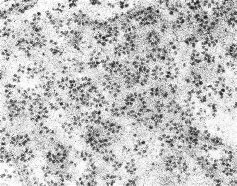 List of electron micrographs of Non-membranous organelles: Ribosome