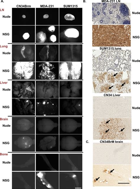 Human breast cancer cells are more metastatic in NSG mice than in nude ...