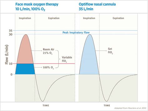 F&P Optiflow™ Mechanisms of Action | Fisher & Paykel Healthcare