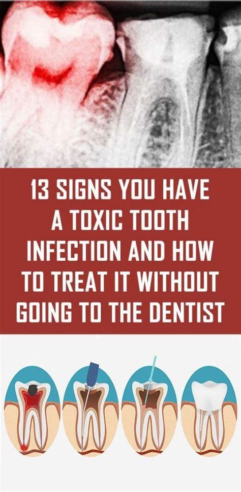 Pin on How To Take Care Of Oral Health