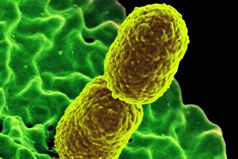 Klebsiella Pneumoniae Microscope