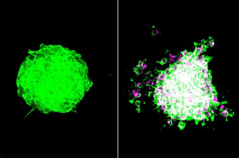 Bacteria in tumors may promote cancer | Science | AAAS