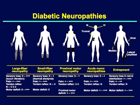 Peripheral Neuropathy — Diagnosis and treatment | by dmemd source | Medium