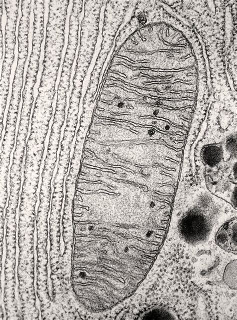 Mitochondria Electron Micrograph Labelled