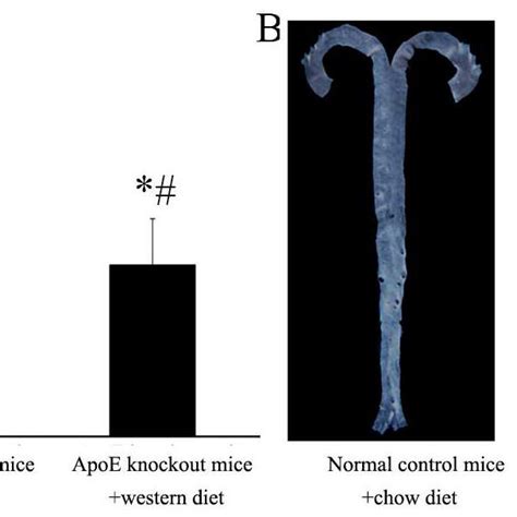 Atherosclerosis is induced in ApoE knockout mice with a western diet A.... | Download Scientific ...