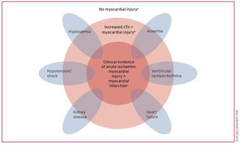 Spectrum of myocardial injury, ranging from no injury to myocardial... | Download Scientific Diagram