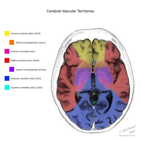 Posterior Cerebral Artery Supplies Which Part Of The Brain - Segments Of The Posterior Cerebral ...