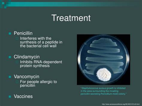 PPT - Streptococcus pyogenes PowerPoint Presentation - ID:291779