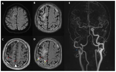 Diagnostics | Free Full-Text | The Clinical Significance of the ...