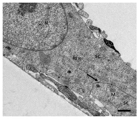 Transmission electron microscopy of the Schwann cells (SC) culture. SC... | Download Scientific ...