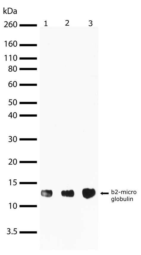 Anti-beta-2 Microglobulin Antibodies | Invitrogen