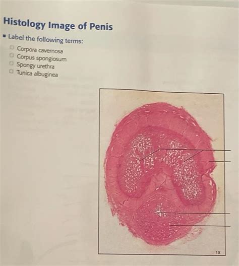 Solved Histology Image of Testis, Increased Magnification | Chegg.com