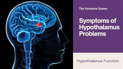 Symptoms of Hypothalamus Problems - YouTube