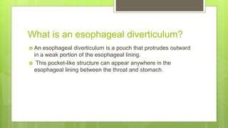 Epiphrenic diverticulum | PPT