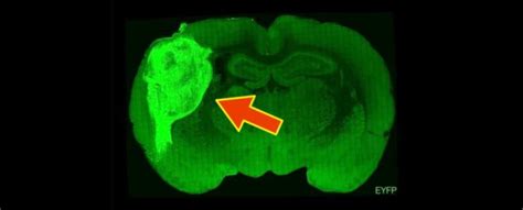 Scientists Spliced Human Brain Tissue Into The Brains of Baby Rats ...