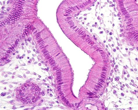 Simple Squamous Epithelium Slide