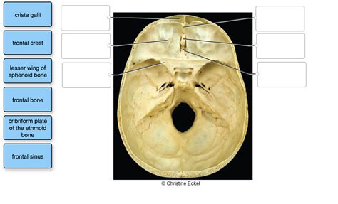 Solved crista galli frontal crest lesser wing of sphenoid | Chegg.com