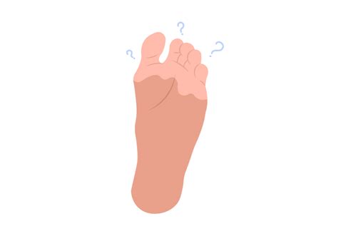 Numbness in Toes | 9 Reasons Your Toes Are Numb | Buoy