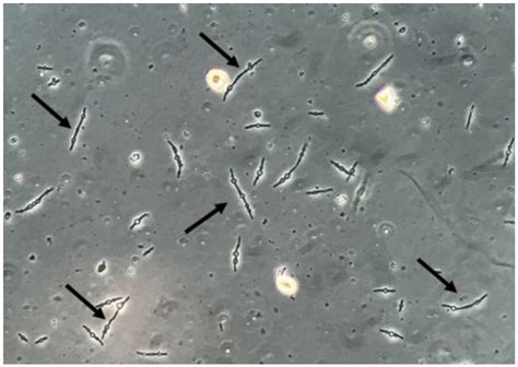 Urine Microscopy Labeled