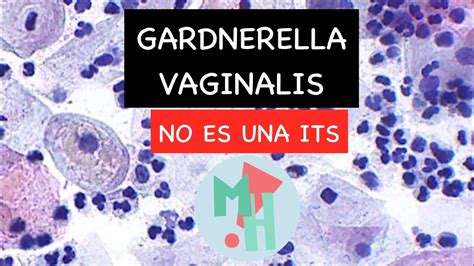 Debes saber esto de Gardnerella vaginalis (NO ES UNA ITS) - YouTube