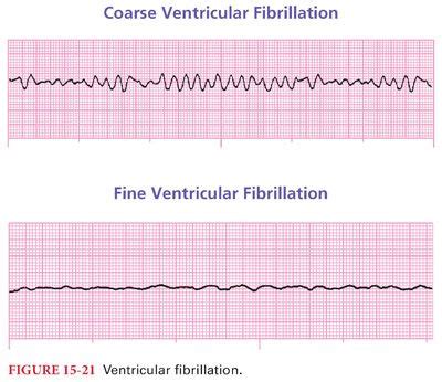 Cardiac Physiology | Basicmedical Key