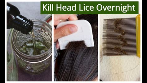 How To Clean Head Lice - Ademploy19