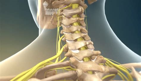 Neck Pain (Cervical Spine)