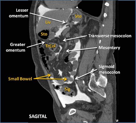 Retroperitoneal Cavity Anatomy