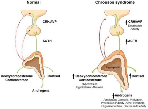 Glucocorticoids function, excess, deficiency, resistance and treatment