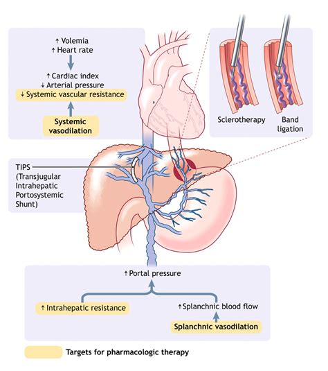 Current management of the complications of portal hypertension ...