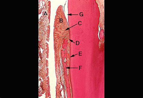 Principal Fibers of PDL